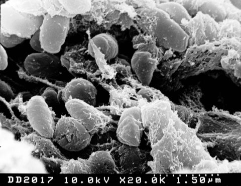 Electron microscope image of rod-shaped plague bacteria (Yersinia pestis) clustered in a flea's foregut.